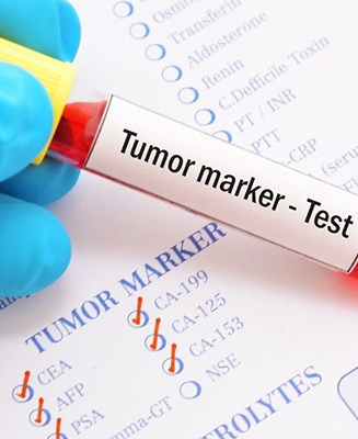 Tumor Marker Rapid Test